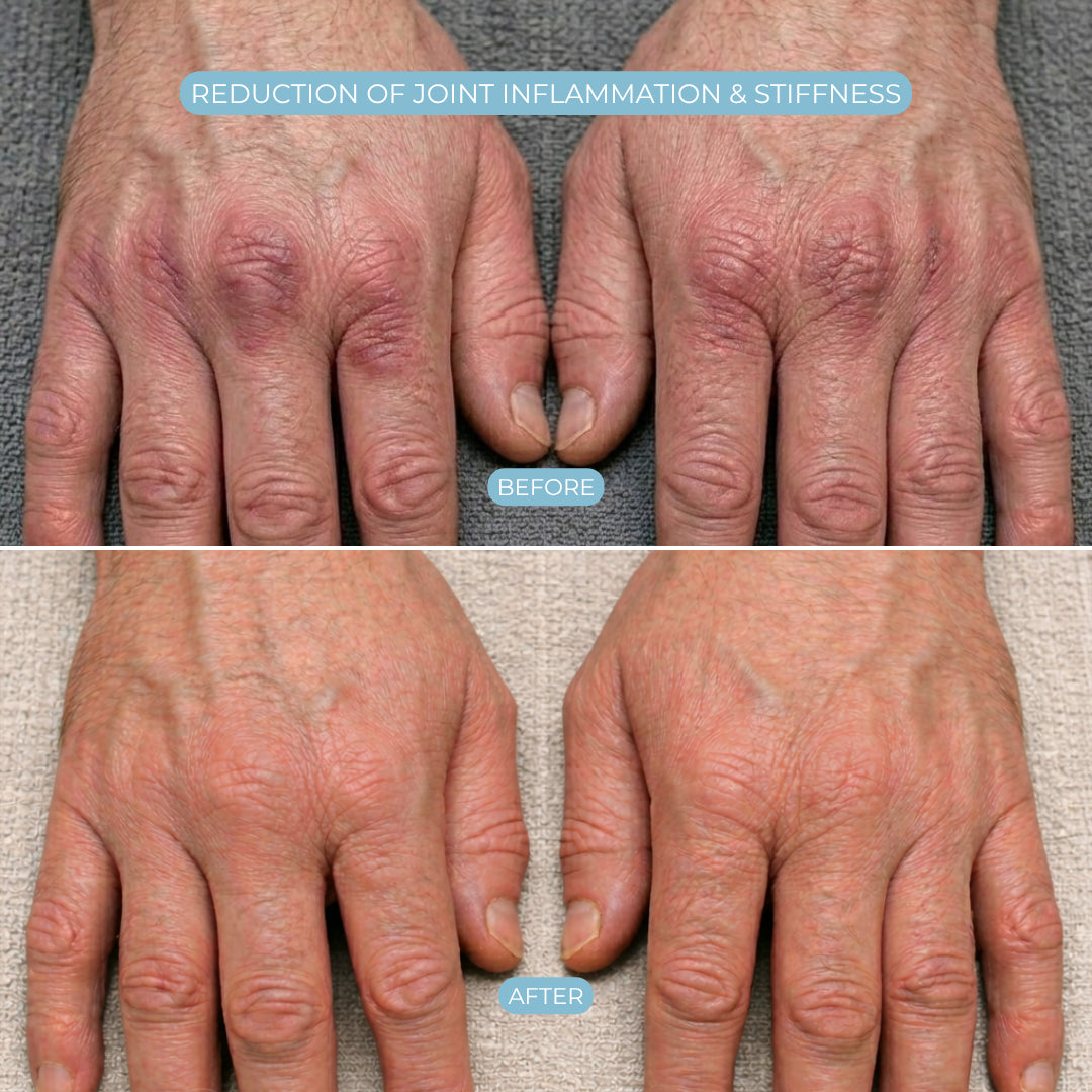 Flexivora HandRelief Pro™